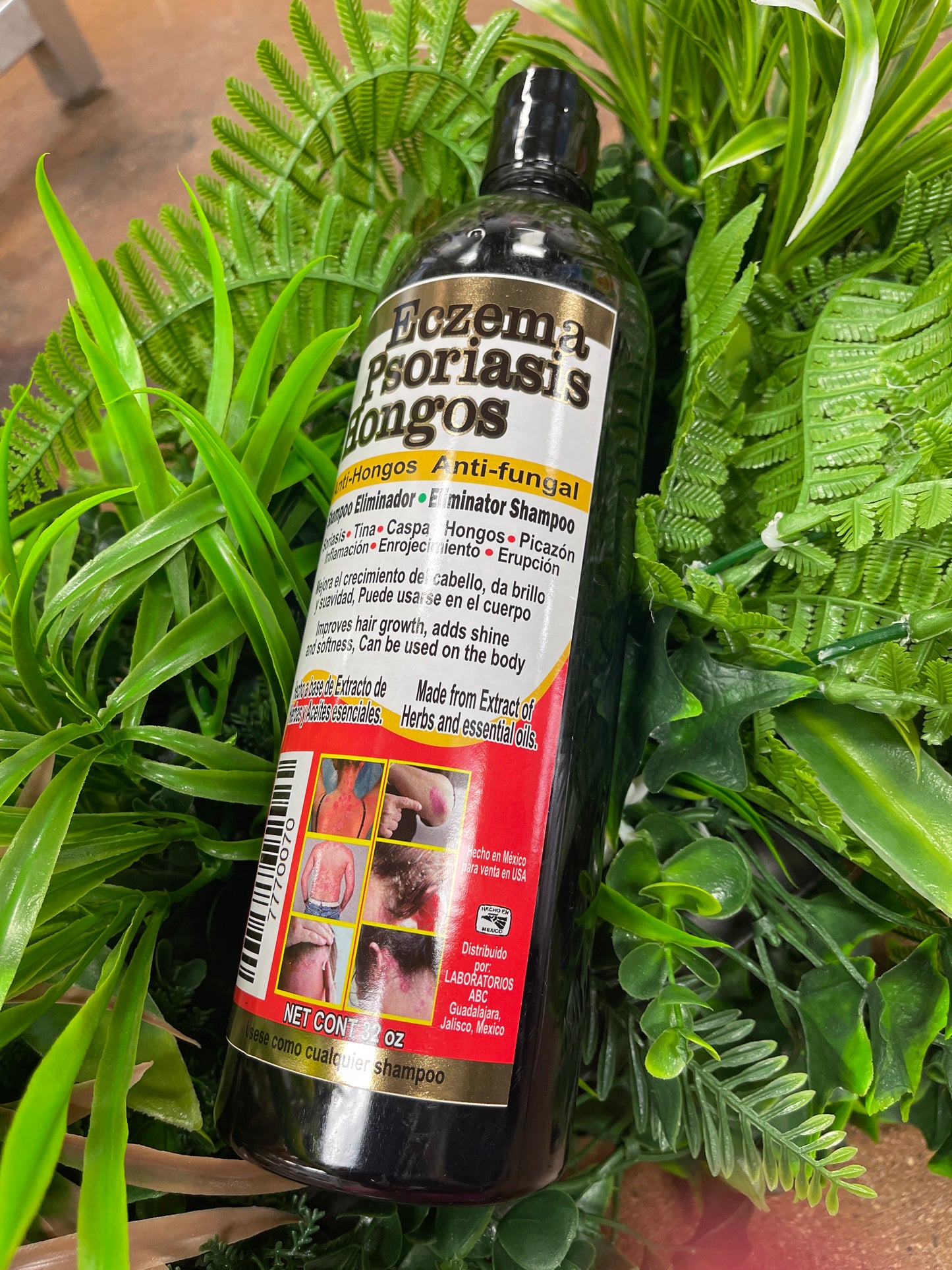 Shampoo Eczema Psoriasis Hongo
